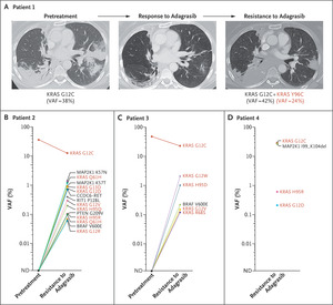 Acquired Resistance to KRASG12C Inhibition in Cancer | NEJM