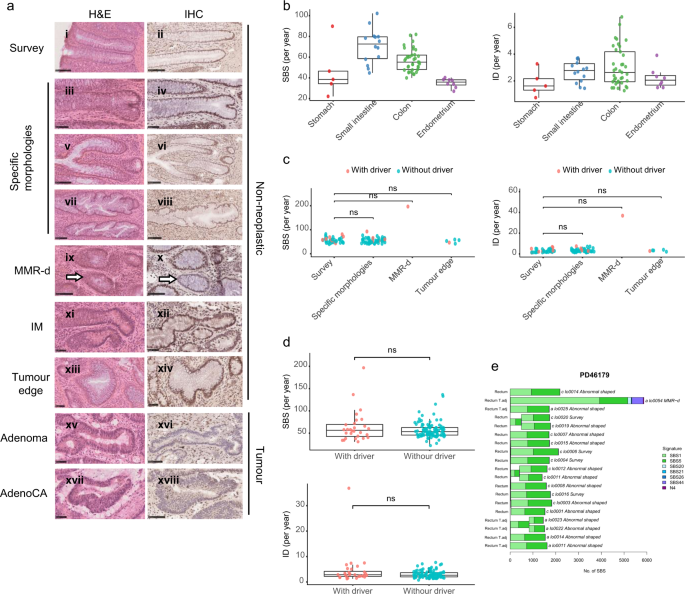 Mutational landscape of normal epithelial cells in Lynch Syndrome patients - Nature Communications